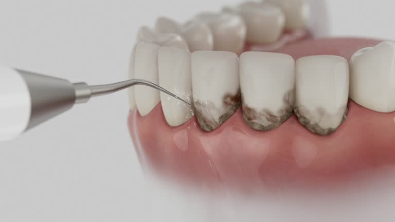 Trusted Teeth Whitening service in Cody, WY - Dentist Open Now